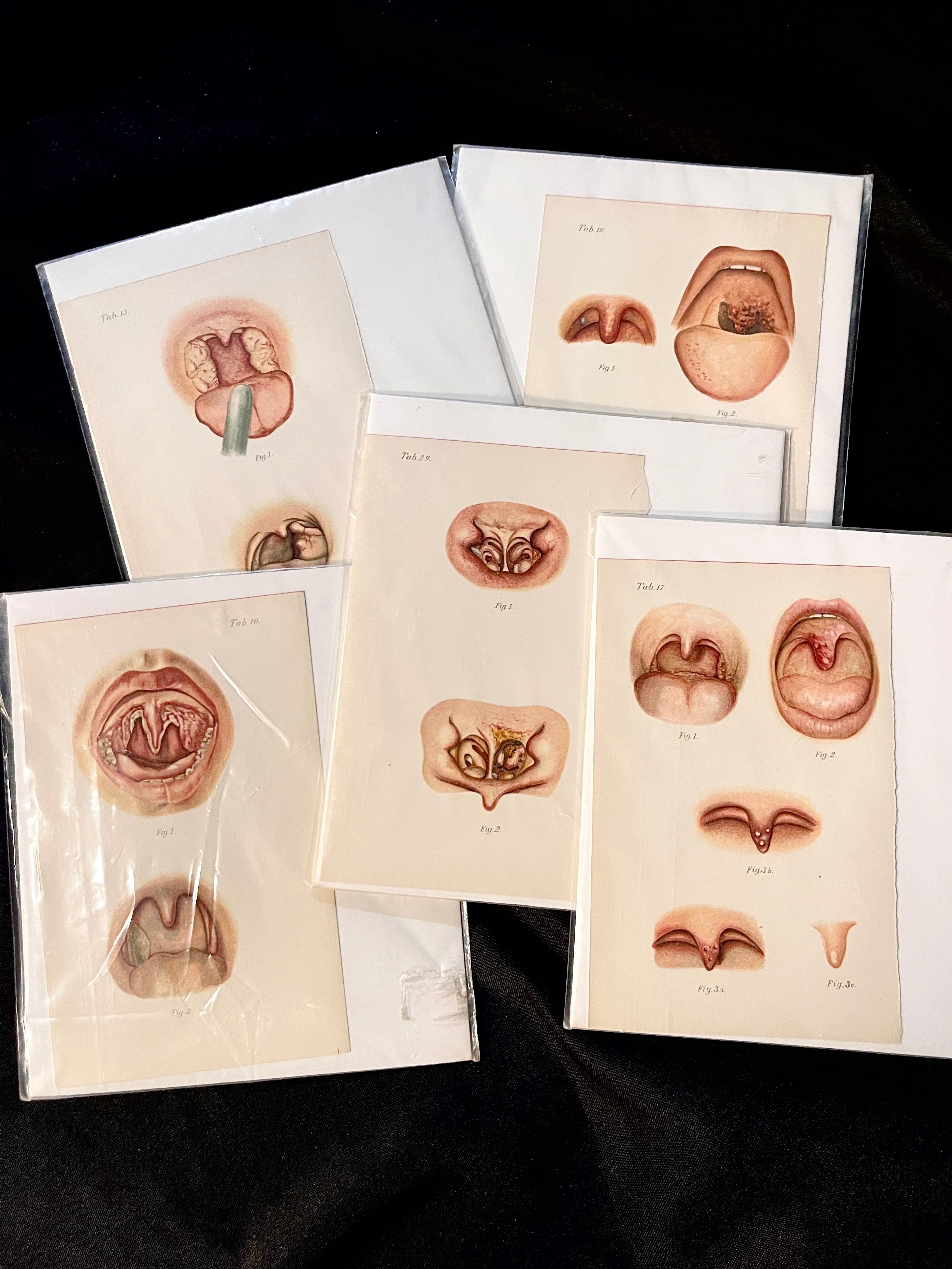 Vintage Oral Disease Medical Prints