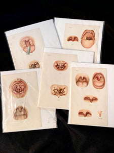 Vintage Oral Disease Medical Prints