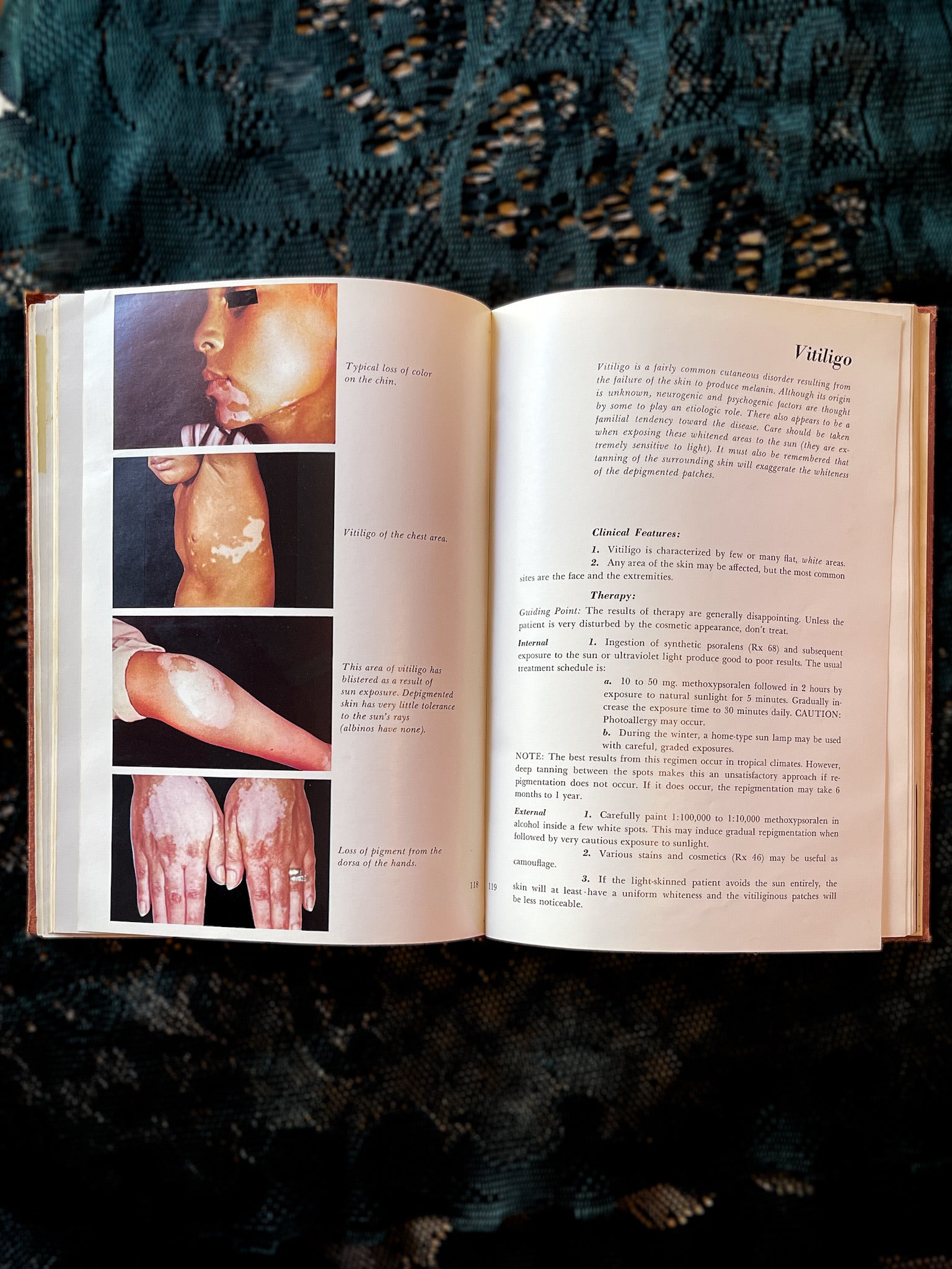 Common Skin Diseases, 1979