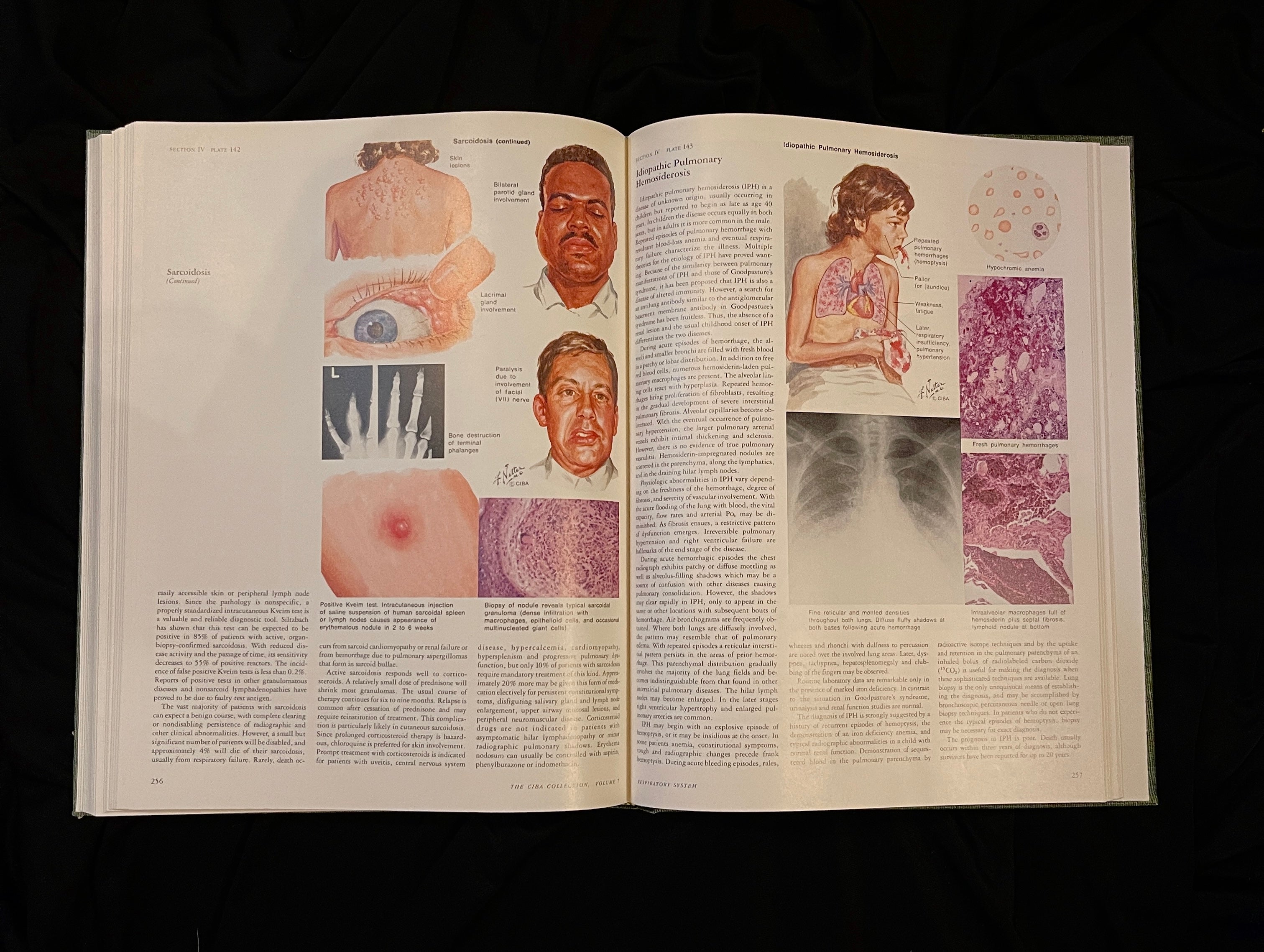 The Ciba Collection of Medical Illustrations, Volume 7: Respiratory System, 1980
