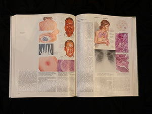 The Ciba Collection of Medical Illustrations, Volume 7: Respiratory System, 1980