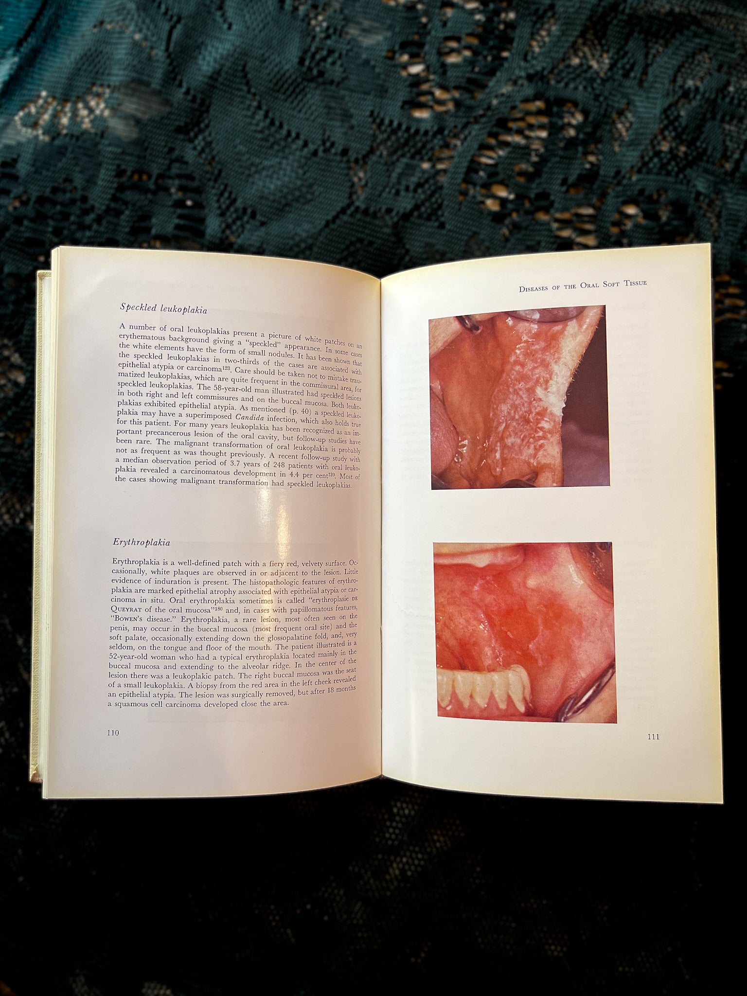 Atlas of Diseases of the Oral Mucosa Book, 1970