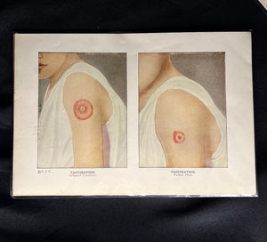 Vintage Medical Print, 1890s