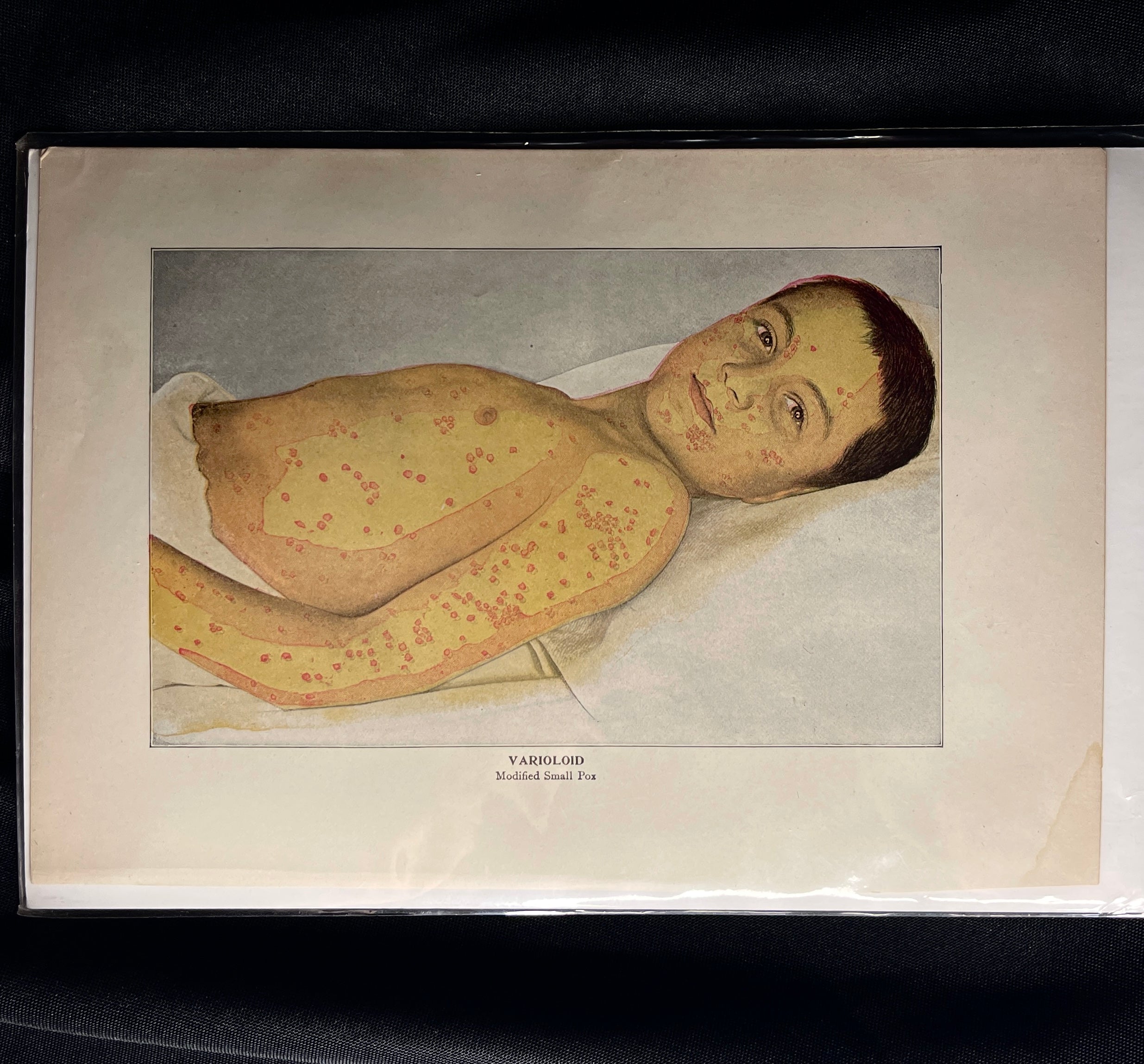 Vintage Medical Print, 1890s