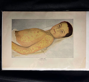 Vintage Medical Print, 1890s