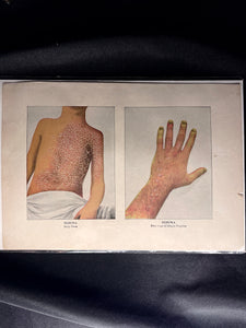 Vintage Medical Print, 1890s