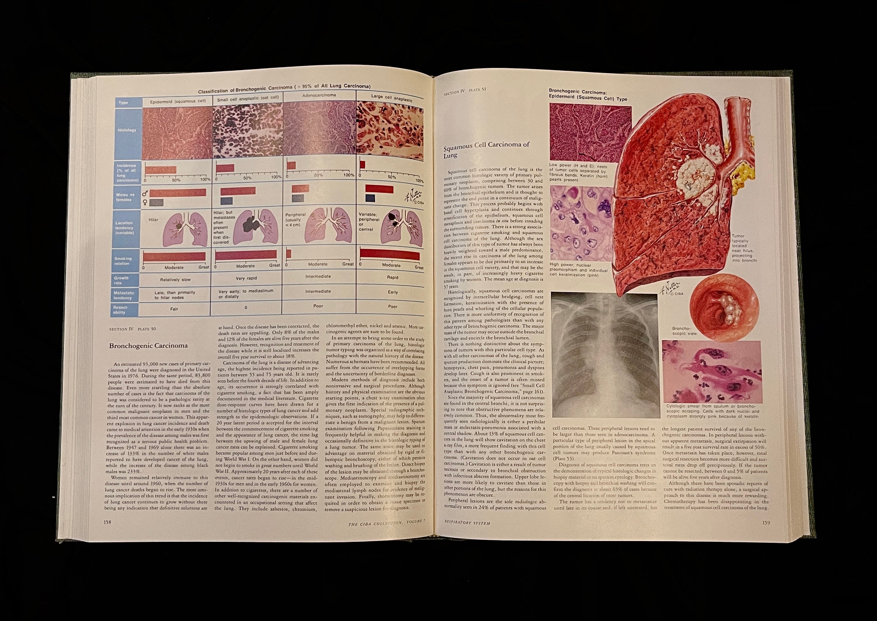 The Ciba Collection of Medical Illustrations, Volume 7: Respiratory System, 1980