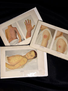 Vintage Medical Print, 1890s